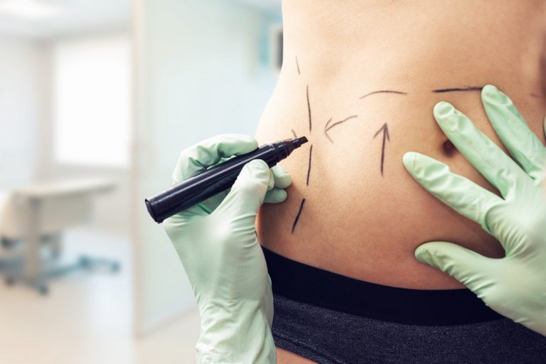 Tout savoir sur la chirurgie esthétique