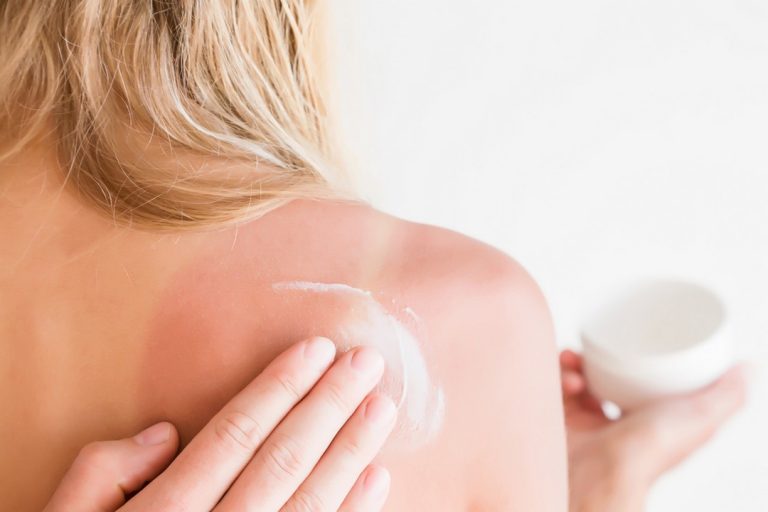 Tout savoir sur les soins après-soleil